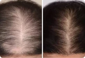 Roota Hair Growth Serum customer - Tina K,  ~FL, USA